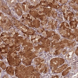 SPATA45 Antibody, Novus Biologicals:Antibodies:Primary Antibodies