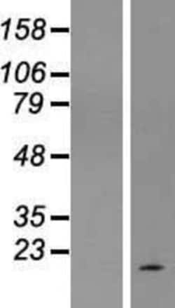 Novus Biologicals&trade;&nbsp;SPATA45 Overexpression Lysate