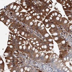 ARMH1 Antibody, Novus Biologicals 25 &mu;L, Unlabeled:Antibodies, Polyclonal