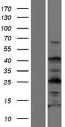 Novus Biologicals TEX35 Overexpression Lysate 0.1mg:Protein Analysis Reagents,