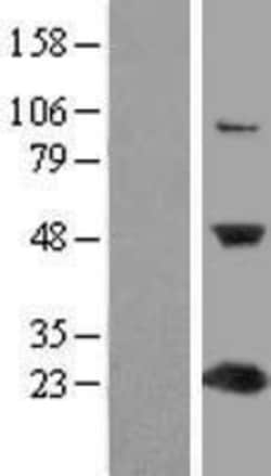 Novus Biologicals&trade;&nbsp;C1orf50 Overexpression Lysate