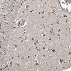 C1orf50 Antibody, Novus Biologicals 25 &mu;L; Unlabeled:Antibodies, Polyclonal
