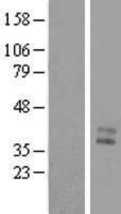 Novus Biologicals&trade;&nbsp;MENT Overexpression Lysate