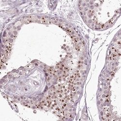 MENT Antibody, Novus Biologicals 0.1mL; Unlabeled:Antibodies, Polyclonal