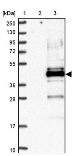 MENT Antibody, Novus Biologicals 25 &mu;L, Unlabeled:Antibodies, Polyclonal