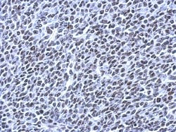RSRP1 Antibody, Novus Biologicals 0.1 mL | Buy Online | Novus Biologicals | Fisher Scientific