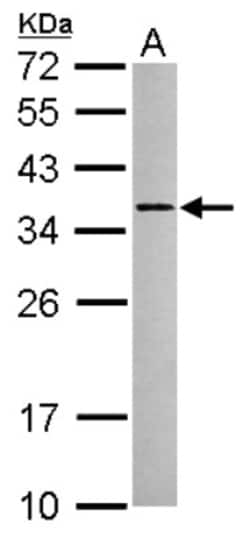 RSRP1 Antibody, Novus Biologicals 0.1 mL | Buy Online | Novus Biologicals | Fisher Scientific
