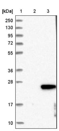 ERRF Antibody, Novus Biologicals 25 &mu;L; Unlabeled:Antibodies, Polyclonal