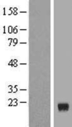 Novus Biologicals&trade;&nbsp;ERRF Overexpression Lysate