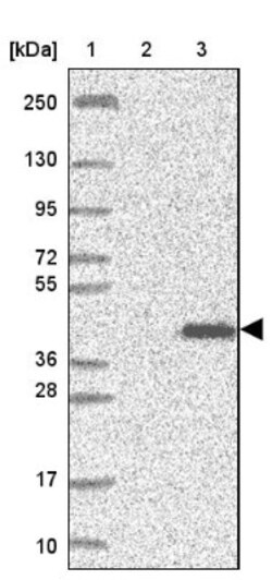 IBA57 Antibody, Novus Biologicals 0.1mL; Unlabeled:Antibodies, Polyclonal