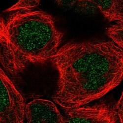 IBA57 Antibody, Novus Biologicals 0.1mL; Unlabeled:Antibodies, Polyclonal