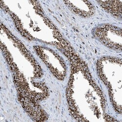 IBA57 Antibody, Novus Biologicals 0.1mL; Unlabeled:Antibodies, Polyclonal