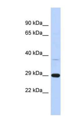 C1orf74 Antibody, Novus Biologicals 100μL; Unlabeled:Antibodies, Polyclonal
