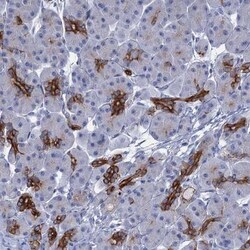 FAAP20 Antibody, Novus Biologicals:Antibodies:Primary Antibodies