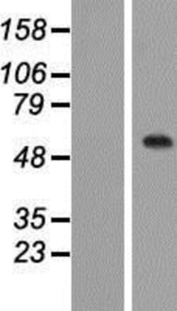 Novus Biologicals&trade;&nbsp;C1orf87 Overexpression Lysate