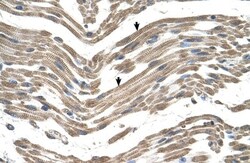 C1QB Antibody, Novus Biologicals 100&mu;L; Unlabeled:Antibodies, Polyclonal