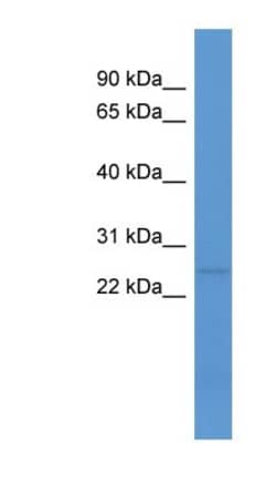 C1QL1 Antibody, Novus Biologicals 100&mu;L; Unlabeled:Antibodies, Polyclonal