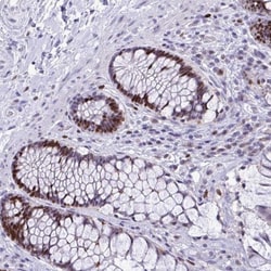 C1qTNF10/C1qL2 Antibody, Novus Biologicals 0.1mL; Unlabeled:Antibodies,