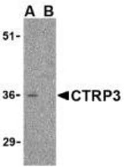 C1qTNF3/CORS26/CTRP3 Antibody - BSA Free, Novus Biologicals 0.1mg; Unlabeled:Antibodies,