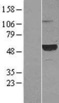 Novus Biologicals™ Complement Component C1rLP Overexpression Lysate