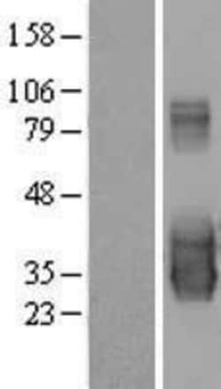 Novus Biologicals BAD-LAMP/LAMP5 Overexpression Lysate 0.1 mg | Buy Online | Novus Biologicals&trade; | Fisher Scientific