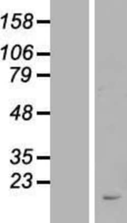 Novus Biologicals&trade;&nbsp;FAM209B Overexpression Lysate