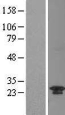 Novus Biologicals™ TWA1 Overexpression Lysate