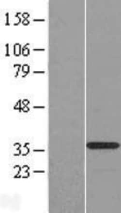 Novus Biologicals&trade;&nbsp;OSER1 Overexpression Lysate