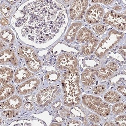OSER1 Antibody, Novus Biologicals:Antibodies:Primary Antibodies
