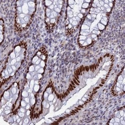 Nucleolar Protein 4 Like Antibody, Novus Biologicals 25 &mu;L | Buy Online | Novus Biologicals | Fisher Scientific