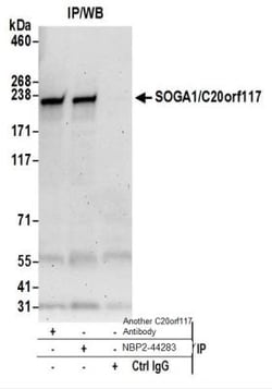 SPACA9 Antibody, Novus Biologicals 100 &mu;L | Buy Online | Novus Biologicals | Fisher Scientific