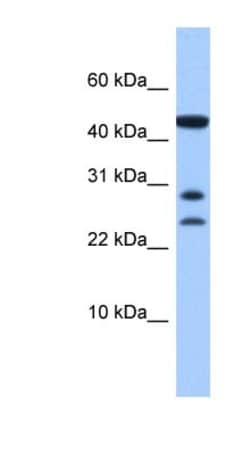 C20ORF141 Antibody, Novus Biologicals 100μL; Unlabeled:Antibodies, Polyclonal