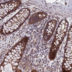 C20orf144 Antibody, Novus Biologicals 25 &mu;L, Unlabeled:Antibodies, Polyclonal