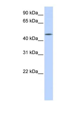 CCM2L Antibody, Novus Biologicals 20 &mu;L | Buy Online | Novus Biologicals | Fisher Scientific