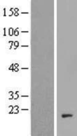 Novus Biologicals&trade;&nbsp;C20orf166 Overexpression Lysate
