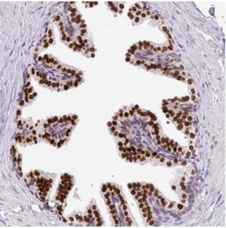 FAM65C Antibody, Novus Biologicals 0.1mL; Unlabeled:Antibodies, Polyclonal