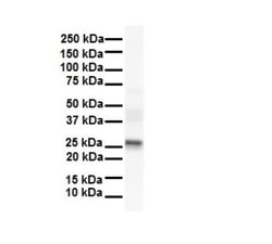 LKAAEAR1 Antibody, Novus Biologicals:Antibodies:Primary Antibodies