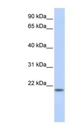 C20orf203 Antibody, Novus Biologicals 100&mu;L; Unlabeled:Antibodies, Polyclonal