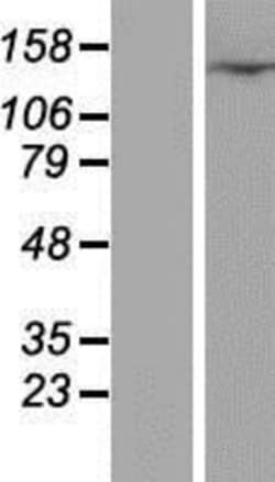Novus Biologicals&trade;&nbsp;CFAP61 Overexpression Lysate