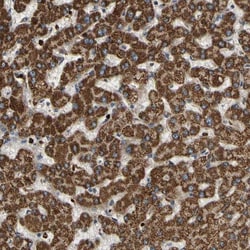 CFAP61 Antibody, Novus Biologicals 25 &mu;L; Unlabeled:Antibodies, Polyclonal
