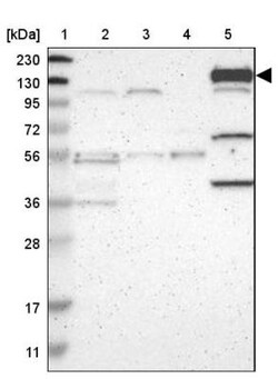 CFAP61 Antibody, Novus Biologicals 25 &mu;L; Unlabeled:Antibodies, Polyclonal