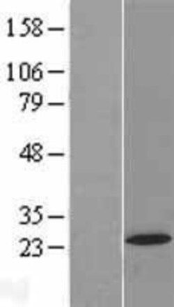 Novus Biologicals&trade;&nbsp;AP5S1 Overexpression Lysate