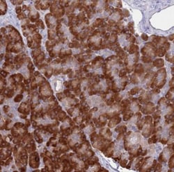 AP5S1 Antibody, Novus Biologicals 25 &mu;L, Unlabeled:Antibodies, Polyclonal