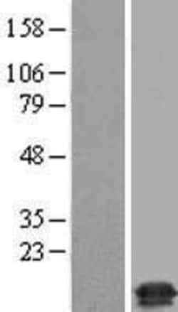 Novus Biologicals&trade;&nbsp;TMEM230 Overexpression Lysate