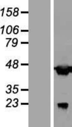 Novus Biologicals&trade;&nbsp;AAR2 Overexpression Lysate