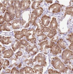 AAR2 Antibody, Novus Biologicals:Antibodies:Primary Antibodies