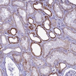 FAM243A Antibody, Novus Biologicals 0.1 mL | Buy Online | Novus Biologicals | Fisher Scientific