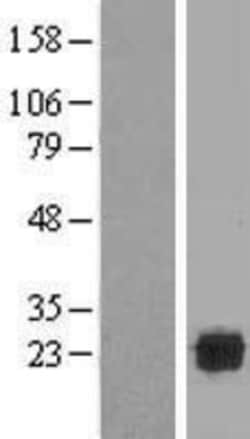 Novus Biologicals&trade;&nbsp;SPATC1L Overexpression Lysate