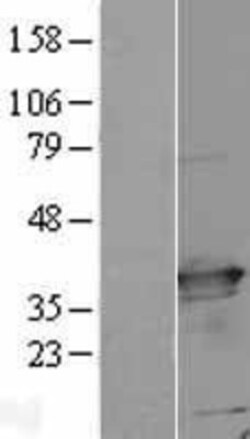 Novus Biologicals&trade;&nbsp;C21orf59 Overexpression Lysate