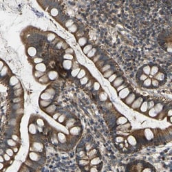 C21orf91 Antibody, Novus Biologicals 0.1mL; Unlabeled:Antibodies, Polyclonal